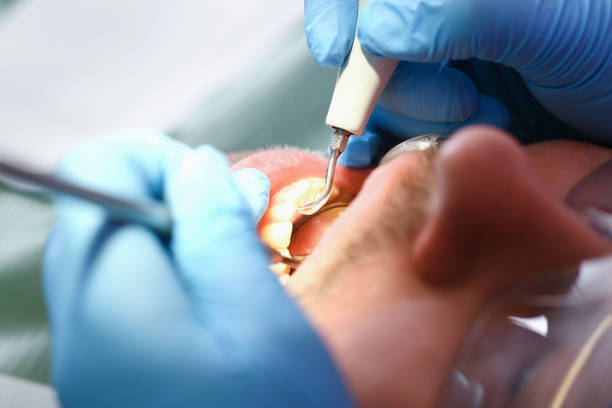 Best Urgent Tooth Repair  in Fayetteville, AL